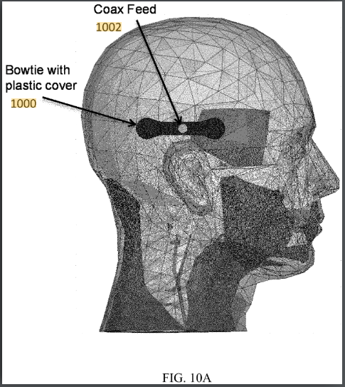 US Patent 11,541,238 B2 Fig 10A