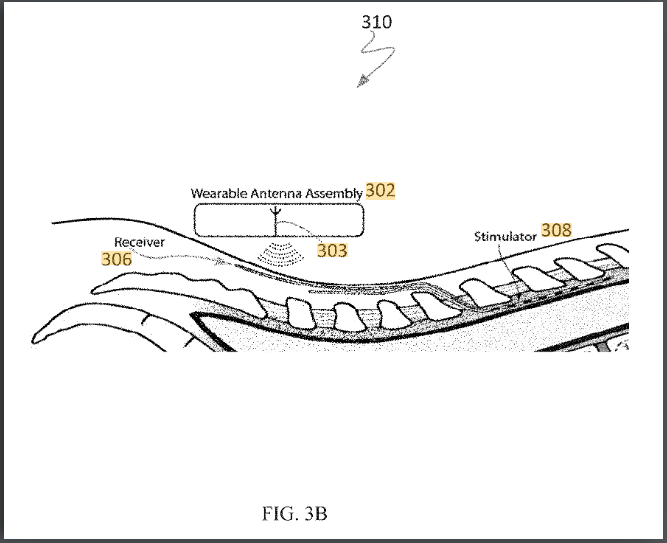 US Patent 10,179,244 B2 Fig 3B